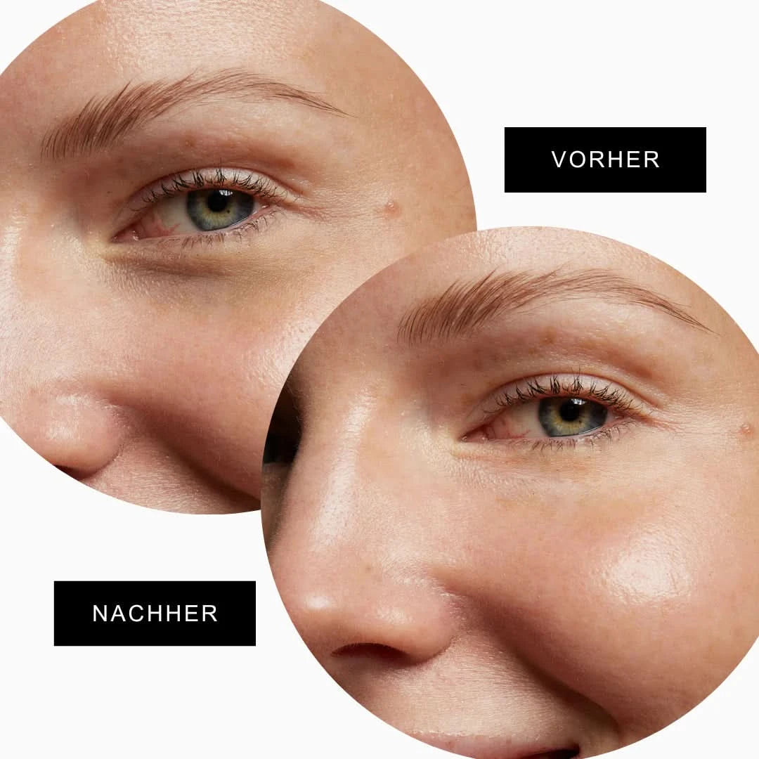 15ML ES + FREE Eye Pads